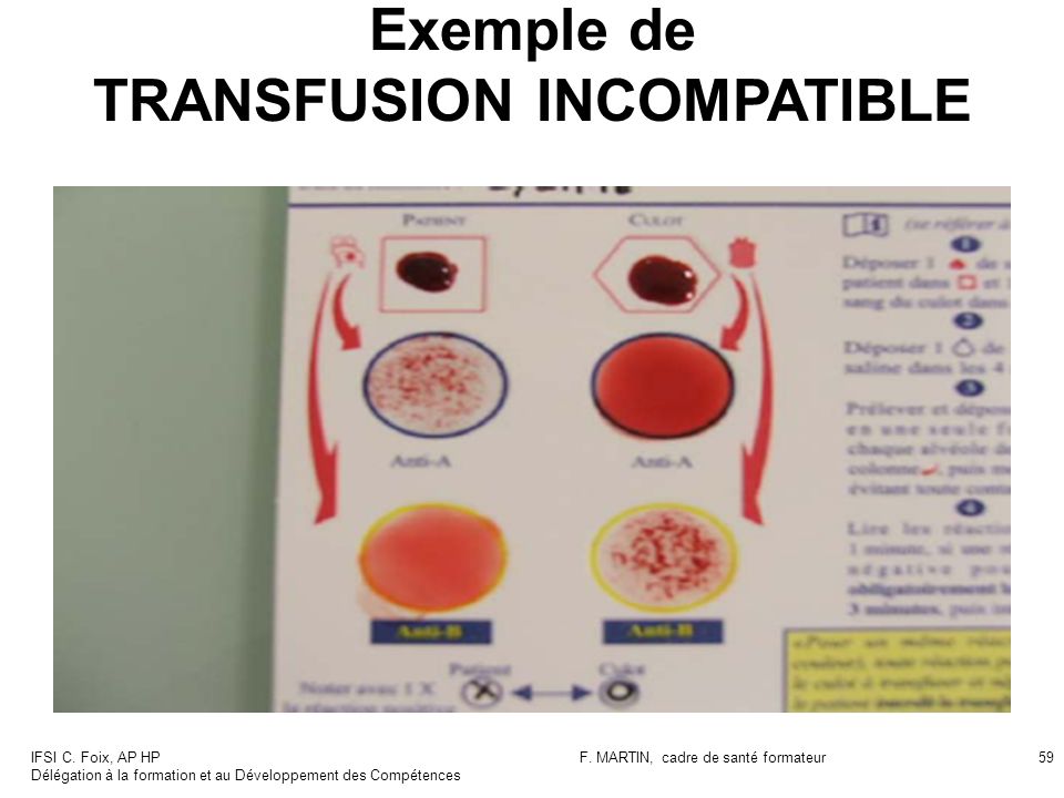 exemple de test ultime transfusion