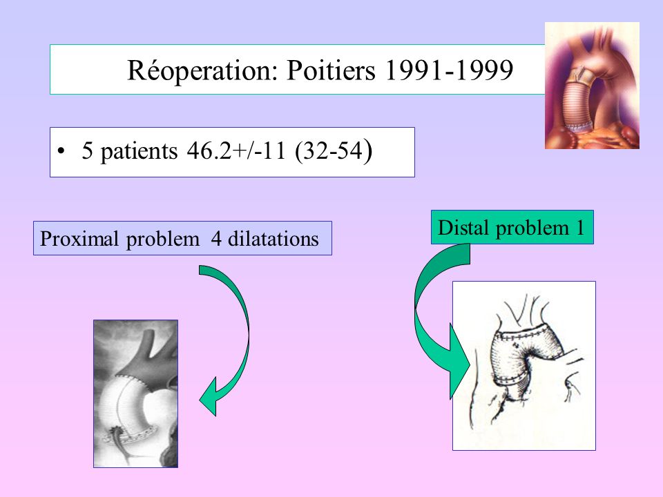 Réoperation: Poitiers patients 46.2+/-11 (32-54 ) Proximal problem 4 dilatations Distal problem 1