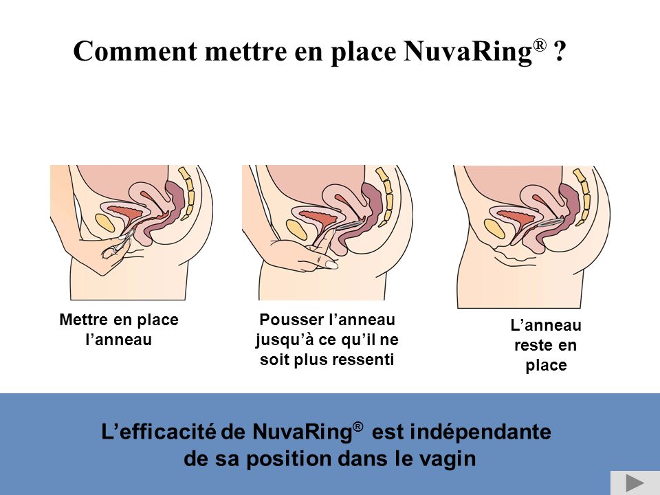 comment prendre ovule