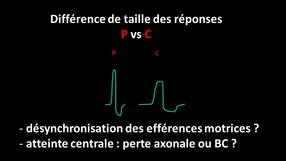 P C Différence de taille des réponses P vs C - désynchronisation des efférences motrices .
