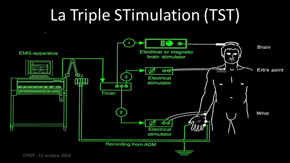 La Triple STimulation (TST) CFSEP - 11 octobre 2014