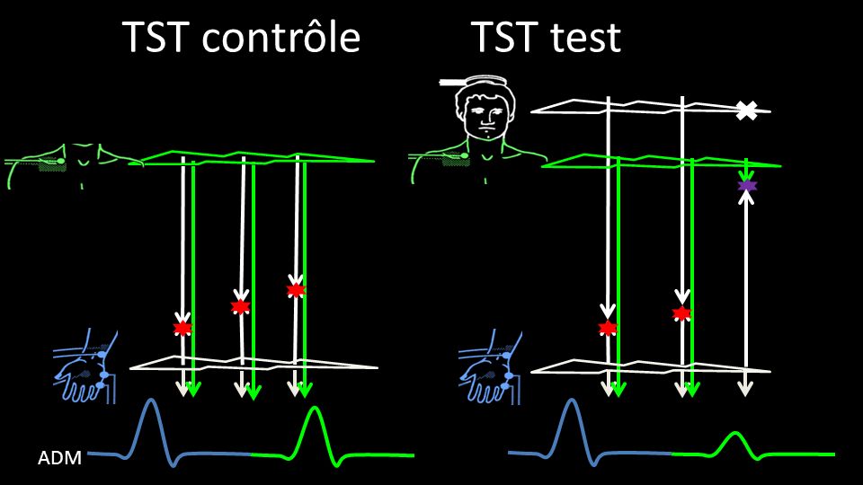 TST contrôle TST test ADM