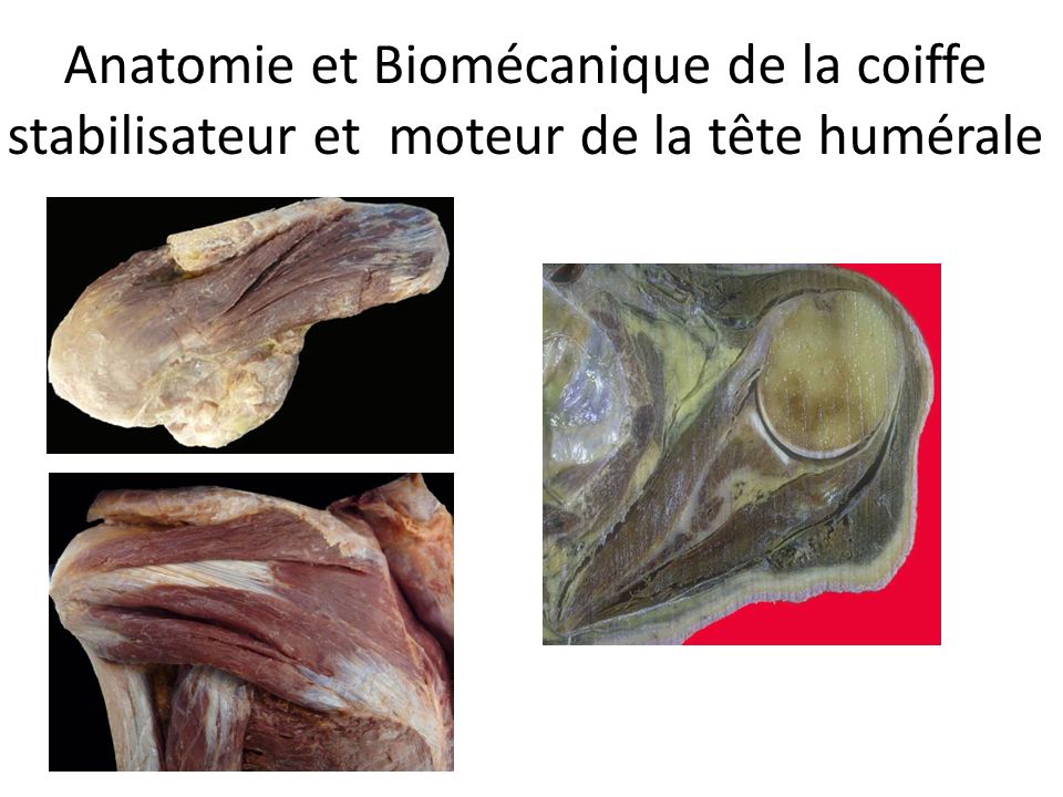 coiffe des rotateurs traitement