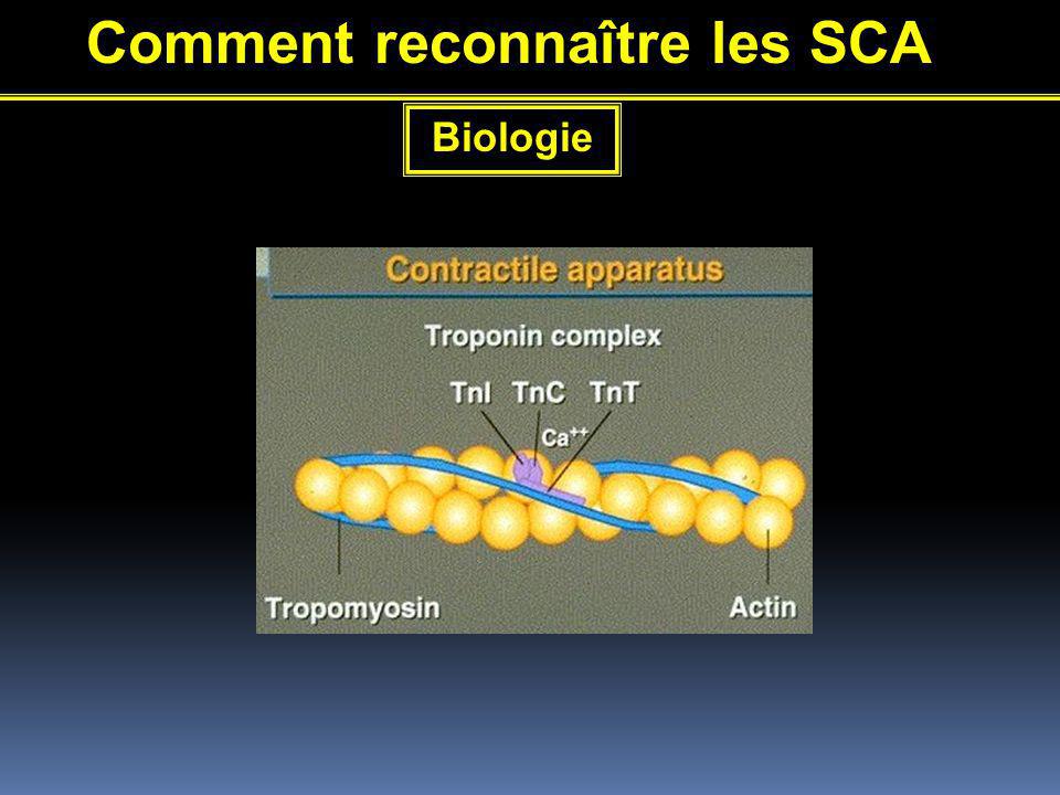 Comment reconnaître les SCA Biologie