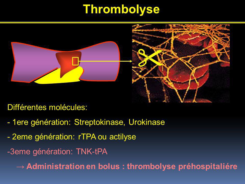 Thrombolyse Différentes molécules: - 1ere génération: Streptokinase, Urokinase - 2eme génération: rTPA ou actilyse -3eme génération: TNK-tPA Administration en bolus : thrombolyse préhospitaliére