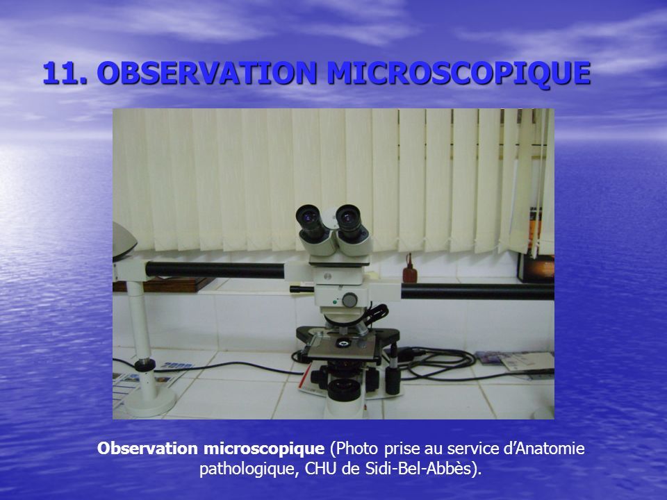 11. OBSERVATION MICROSCOPIQUE 11.