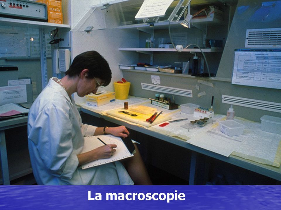 La macroscopie