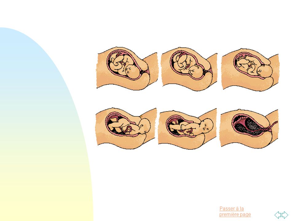 L Accouchement Normal En Presentation Cephalique Ppt Video Online Telecharger