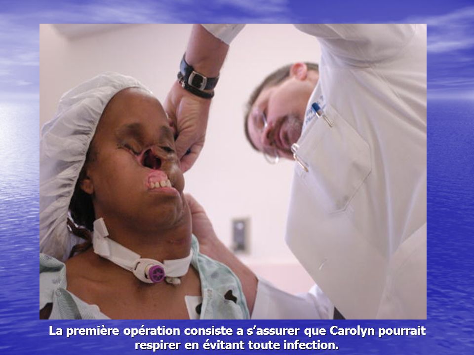 La première opération consiste a sassurer que Carolyn pourrait respirer en évitant toute infection.