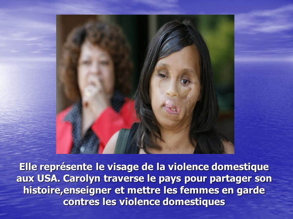 Elle représente le visage de la violence domestique aux USA.