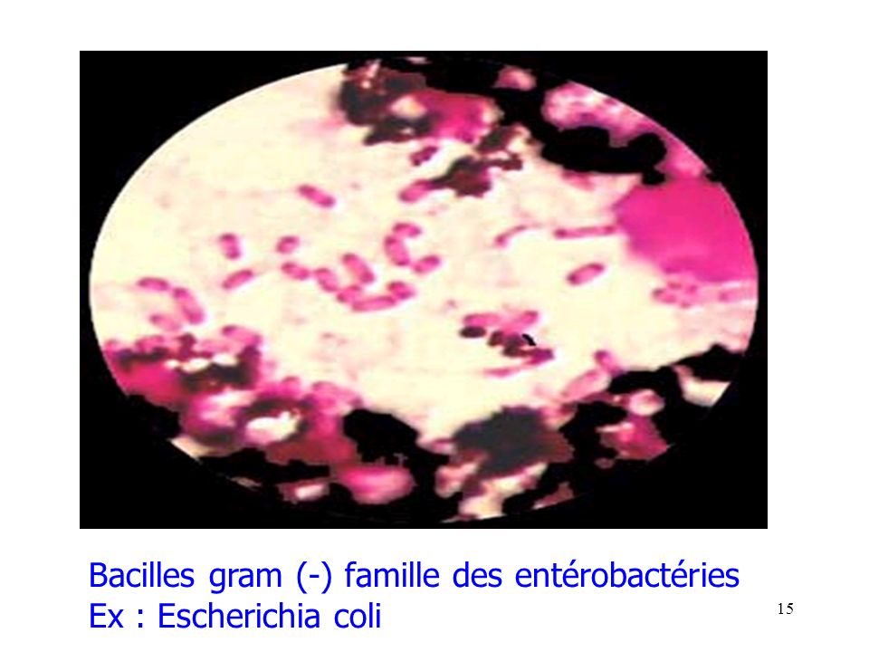 15 Bacilles gram (-) famille des entérobactéries Ex : Escherichia coli
