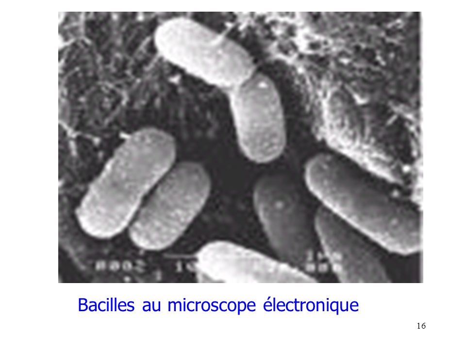 16 Bacilles au microscope électronique