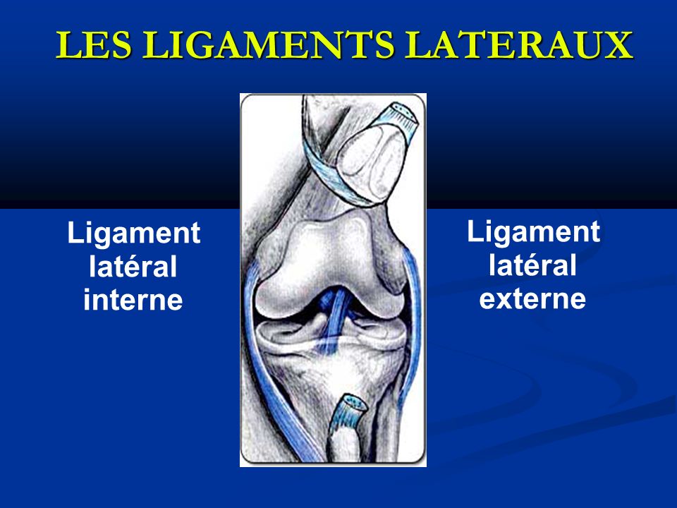LES LIGAMENTS LATERAUX Ligament latéral interne Ligament latéral externe