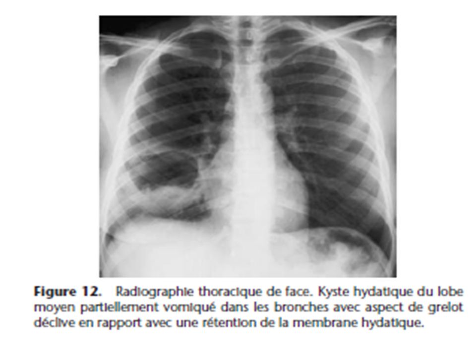 Module De Pneumologie Pr Lellou Salah Ehuo Ppt Video Online Telecharger