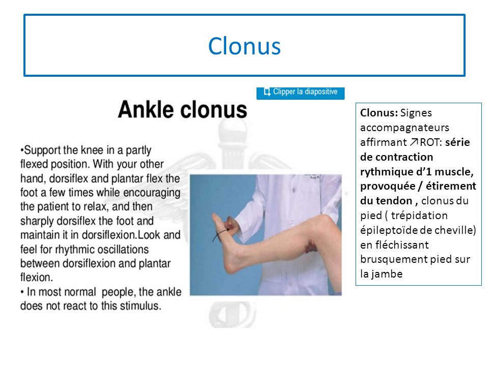 tude de la motricit coordination et r flexes ost otendineux M