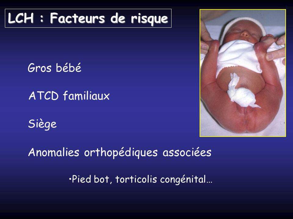 Gros bébé Siège ATCD familiaux Anomalies orthopédiques associées Pied bot, torticolis congénital… LCH : Facteurs de risque