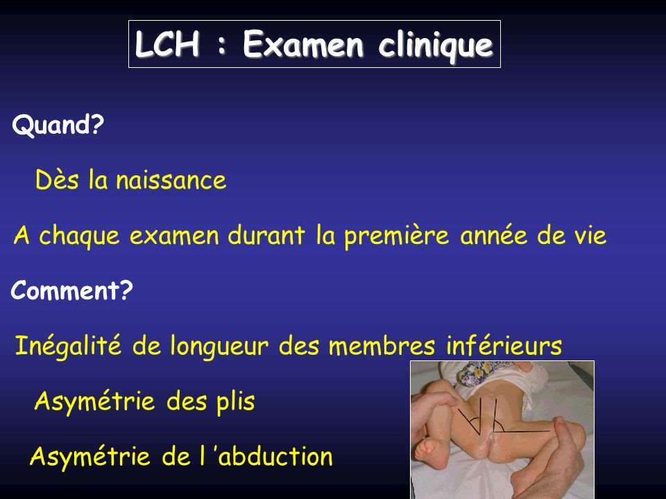 LCH : Examen clinique Quand. Comment.