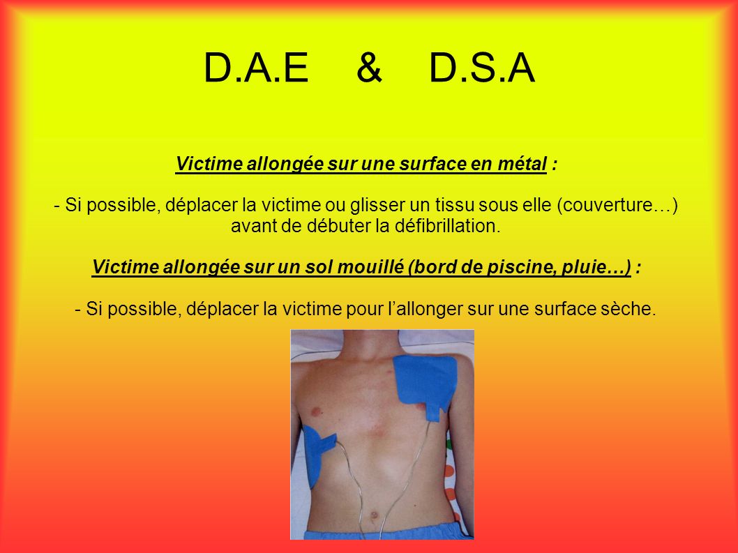 D.A.E & D.S.A Victime allongée sur une surface en métal : - Si possible, déplacer la victime ou glisser un tissu sous elle (couverture…) avant de débuter la défibrillation.