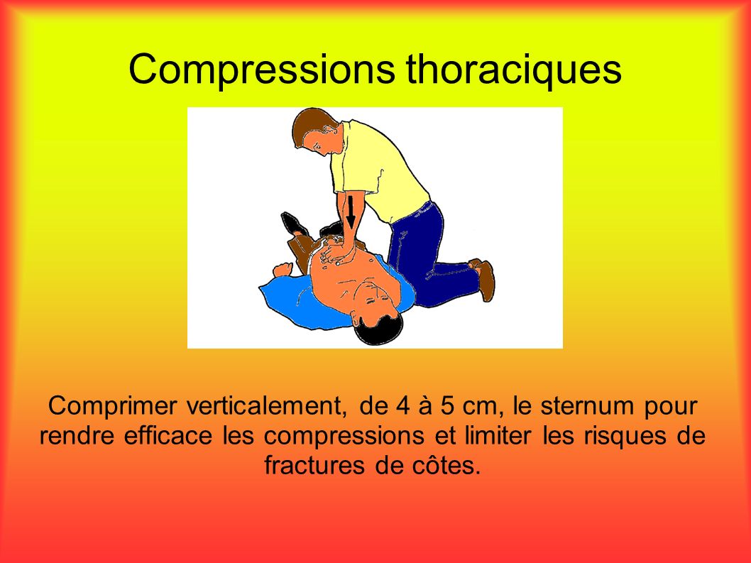Compressions thoraciques Comprimer verticalement, de 4 à 5 cm, le sternum pour rendre efficace les compressions et limiter les risques de fractures de côtes.