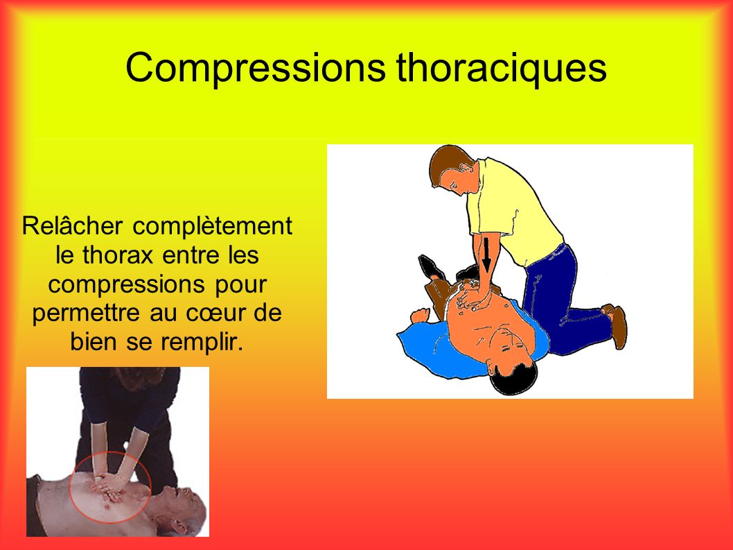 Compressions thoraciques Relâcher complètement le thorax entre les compressions pour permettre au cœur de bien se remplir.