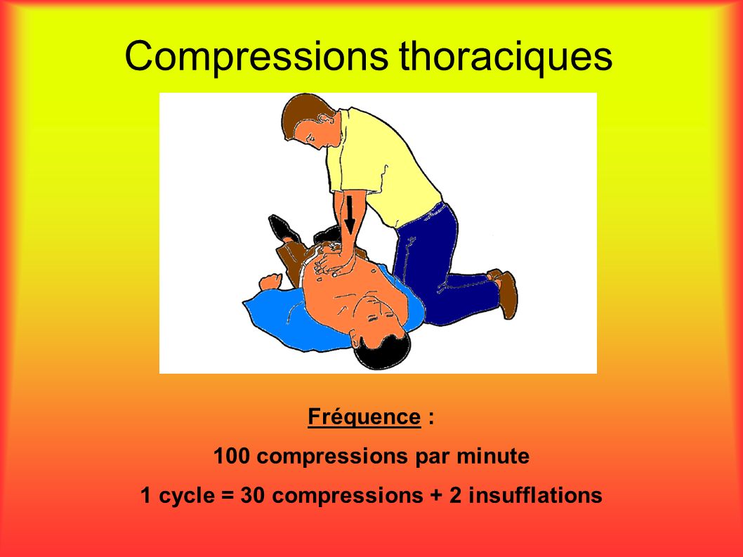 Compressions thoraciques Fréquence : 100 compressions par minute 1 cycle = 30 compressions + 2 insufflations
