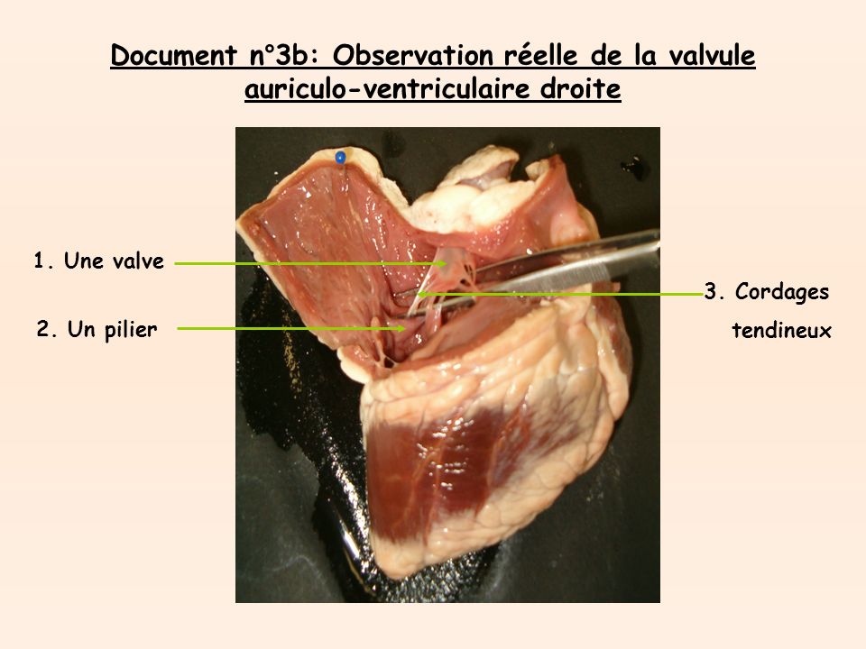 Document n°3b: Observation réelle de la valvule auriculo-ventriculaire droite 1.