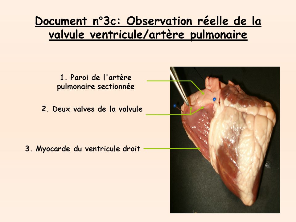 Document n°3c: Observation réelle de la valvule ventricule/artère pulmonaire 1.