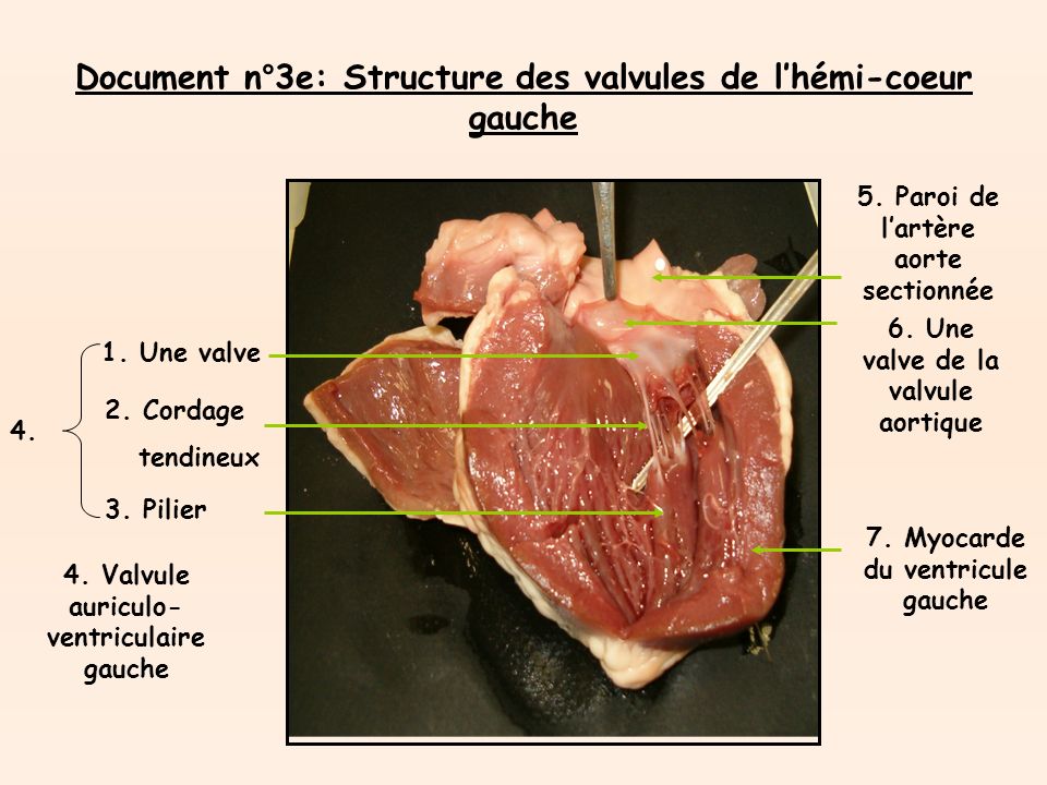 Document n°3e: Structure des valvules de lhémi-coeur gauche 1.