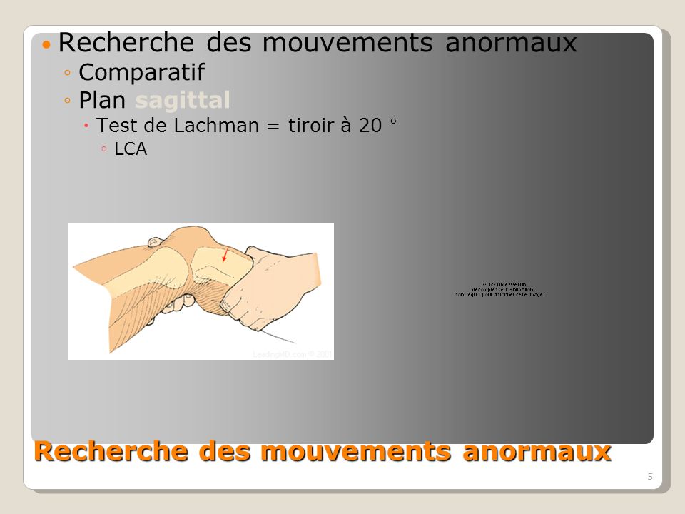 5 Recherche des mouvements anormaux Comparatif Plan sagittal Test de Lachman = tiroir à 20 ° LCA