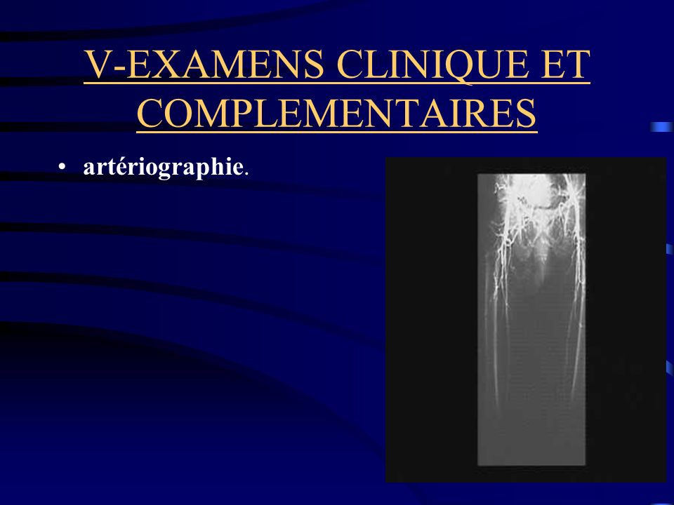 V-EXAMENS CLINIQUE ET COMPLEMENTAIRES artériographie.