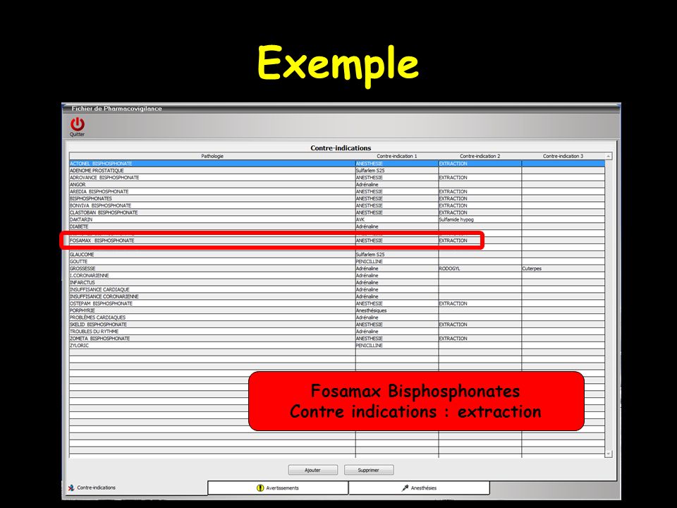 Exemple Fosamax Bisphosphonates Contre indications : extraction