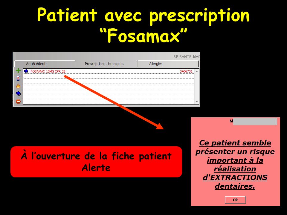 Patient avec prescription Fosamax À louverture de la fiche patient Alerte