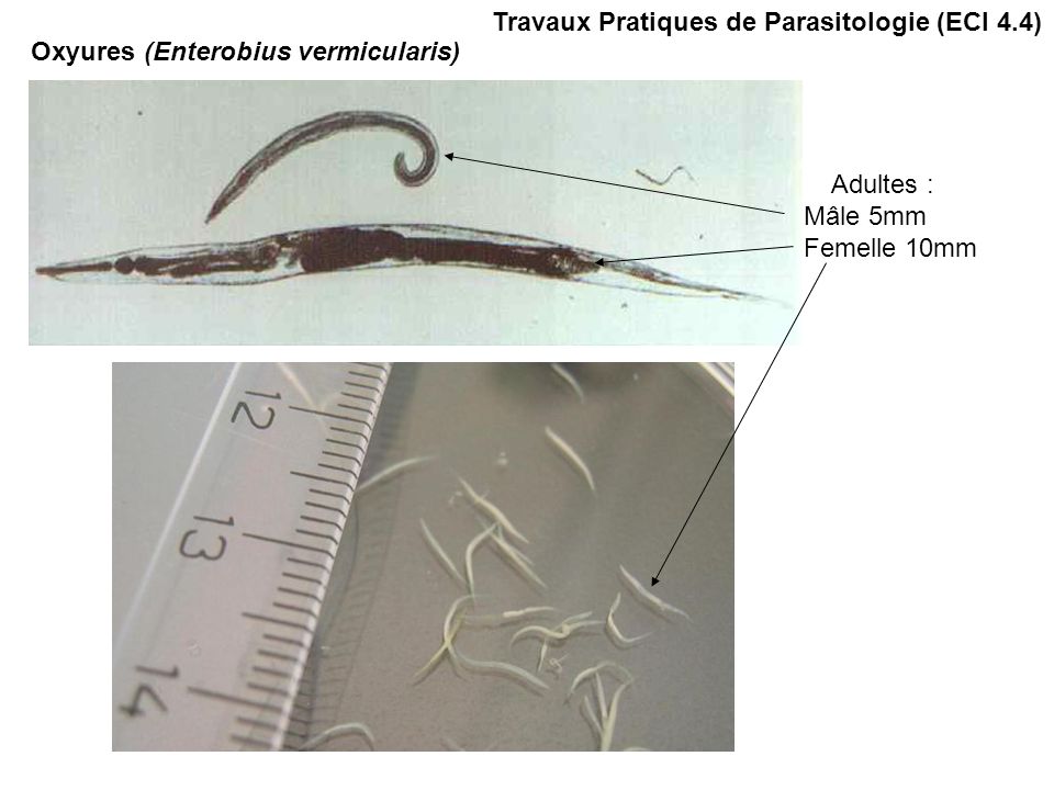 Travaux Pratiques de Parasitologie (ECI 4.4) Adultes : Mâle 5mm Femelle 10mm Oxyures (Enterobius vermicularis)