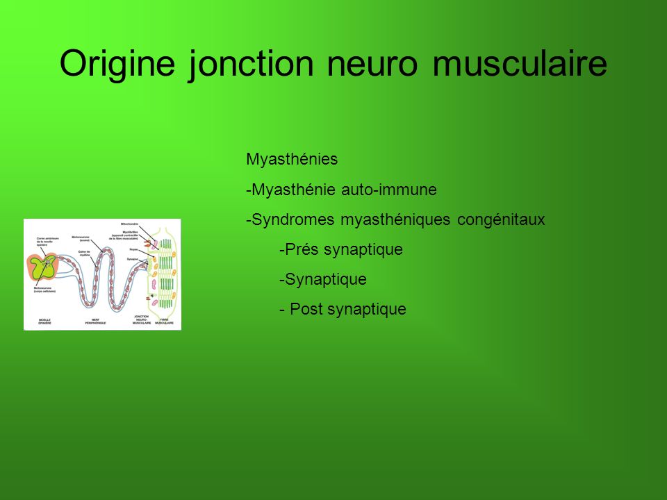 Origine jonction neuro musculaire Myasthénies -Myasthénie auto-immune -Syndromes myasthéniques congénitaux -Prés synaptique -Synaptique - Post synaptique