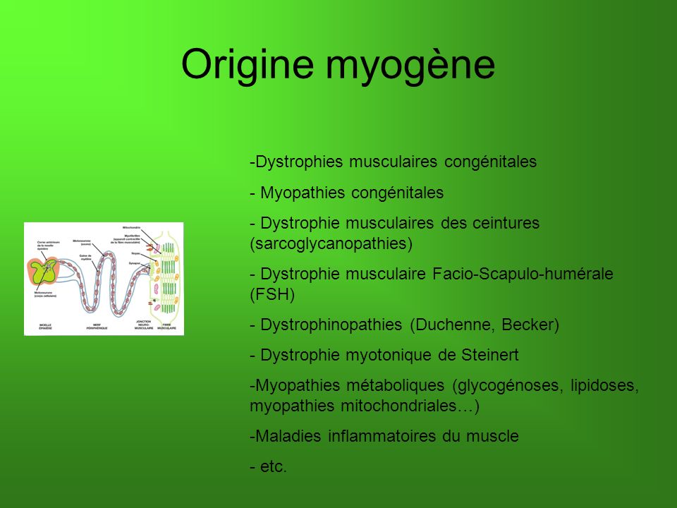 Origine myogène -Dystrophies musculaires congénitales - Myopathies congénitales - Dystrophie musculaires des ceintures (sarcoglycanopathies) - Dystrophie musculaire Facio-Scapulo-humérale (FSH) - Dystrophinopathies (Duchenne, Becker) - Dystrophie myotonique de Steinert -Myopathies métaboliques (glycogénoses, lipidoses, myopathies mitochondriales…) -Maladies inflammatoires du muscle - etc.