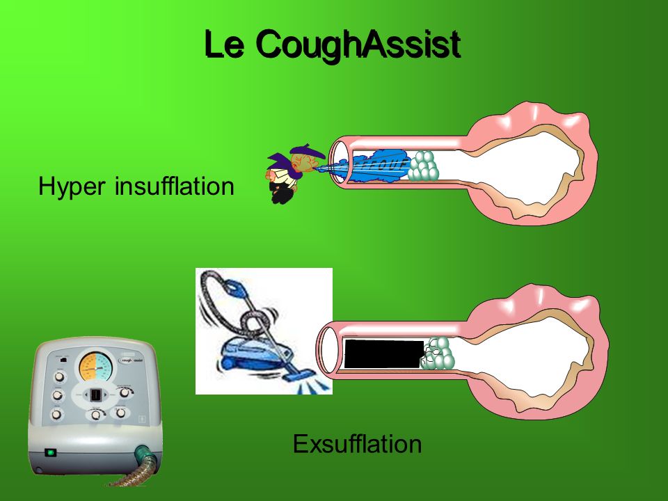 Le CoughAssist Hyper insufflation Exsufflation