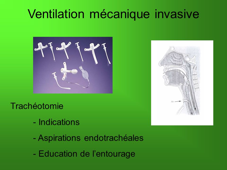 Ventilation mécanique invasive Trachéotomie - Indications - Aspirations endotrachéales - Education de lentourage