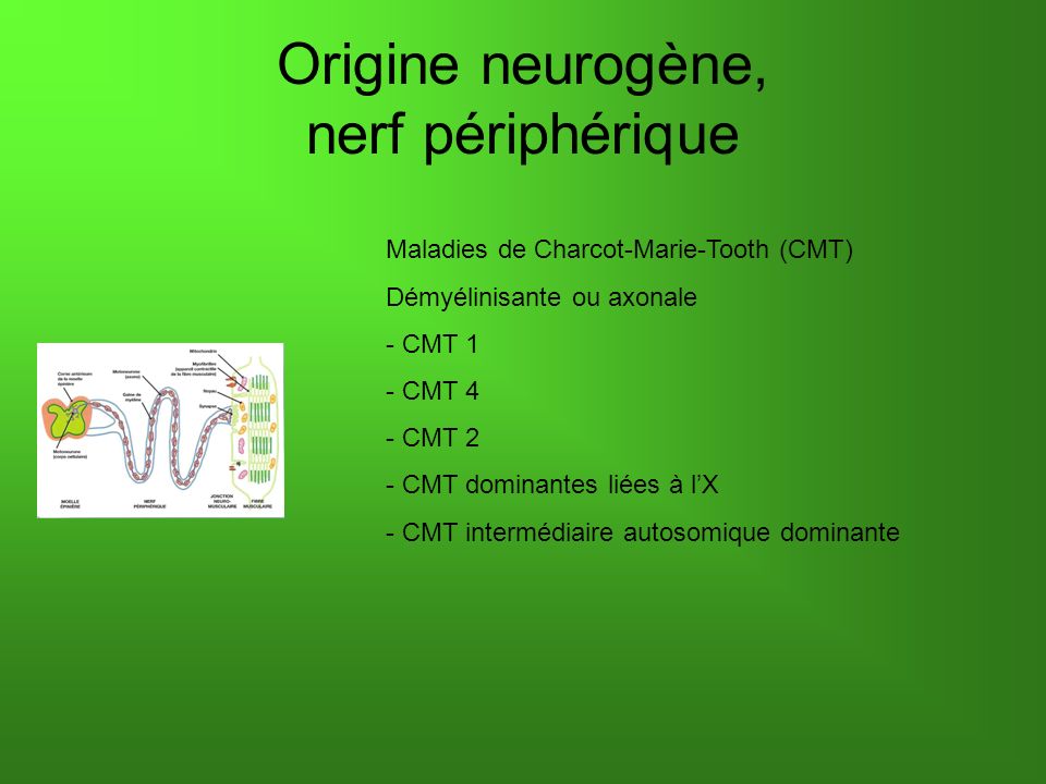 Origine neurogène, nerf périphérique Maladies de Charcot-Marie-Tooth (CMT) Démyélinisante ou axonale - CMT 1 - CMT 4 - CMT 2 - CMT dominantes liées à lX - CMT intermédiaire autosomique dominante