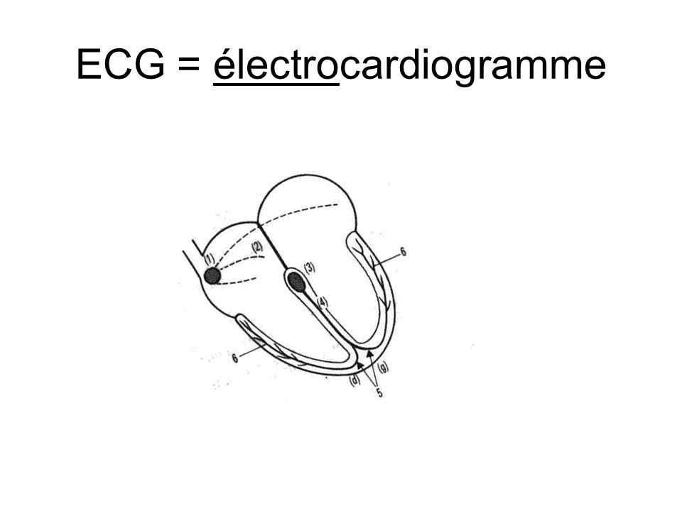 ECG = électrocardiogramme