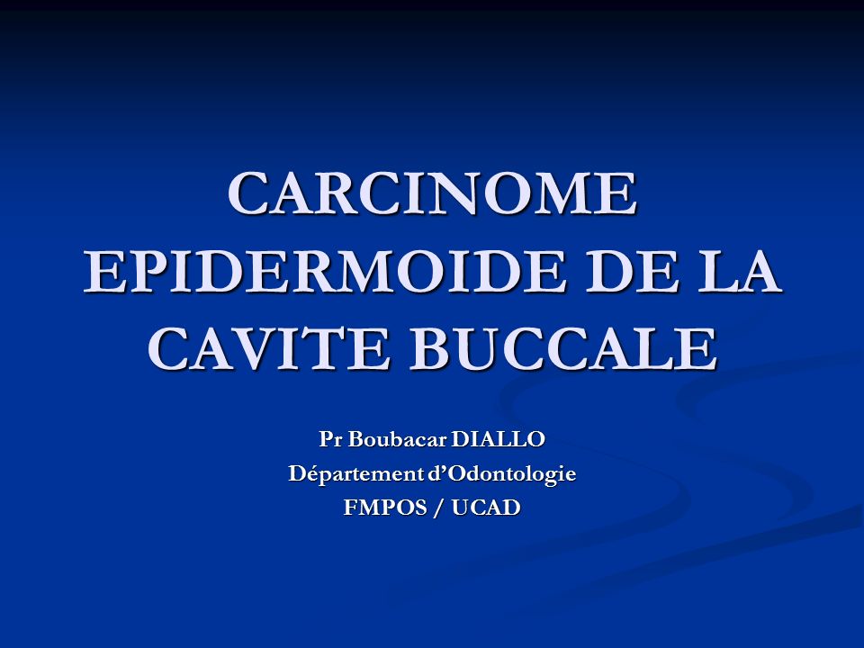 CARCINOME EPIDERMOIDE DE LA CAVITE BUCCALE Pr Boubacar DIALLO Département d’Odontologie FMPOS / UCAD