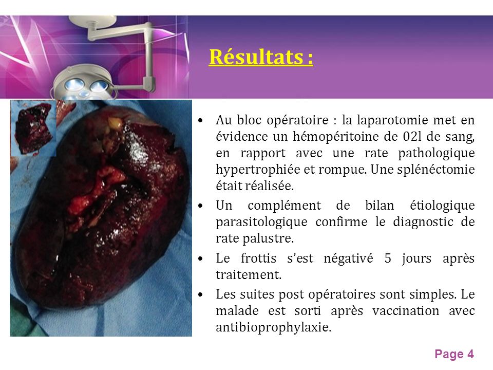 Page 4 Résultats : Au bloc opératoire : la laparotomie met en évidence un hémopéritoine de 02l de sang, en rapport avec une rate pathologique hypertrophiée et rompue.
