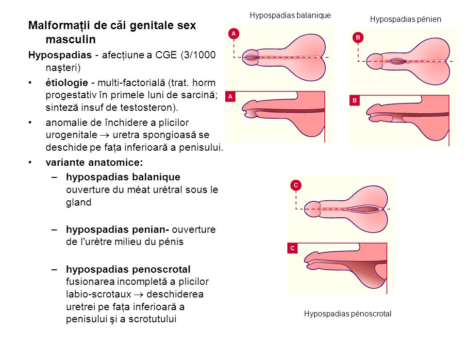 Malformațiile congenitale ale organelor genitale