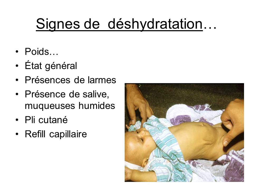 La Rehydratation Chez L Enfant Helene Roy Pediatre Decembre 11 Ppt Telecharger