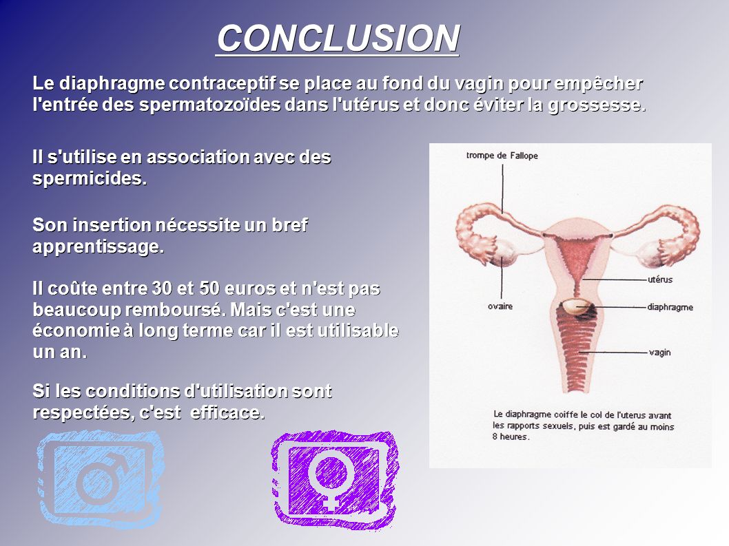 CONCLUSION Le diaphragme contraceptif se place au fond du vagin pour empêcher l entrée des spermatozoïdes dans l utérus et donc éviter la grossesse.