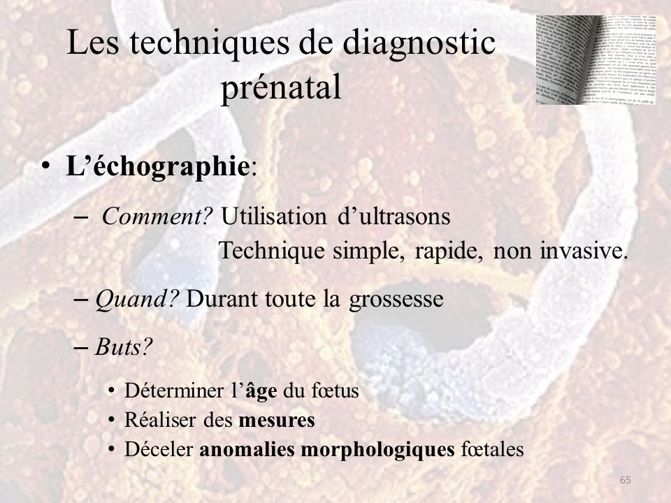 Les techniques de diagnostic prénatal L’échographie: – Comment.