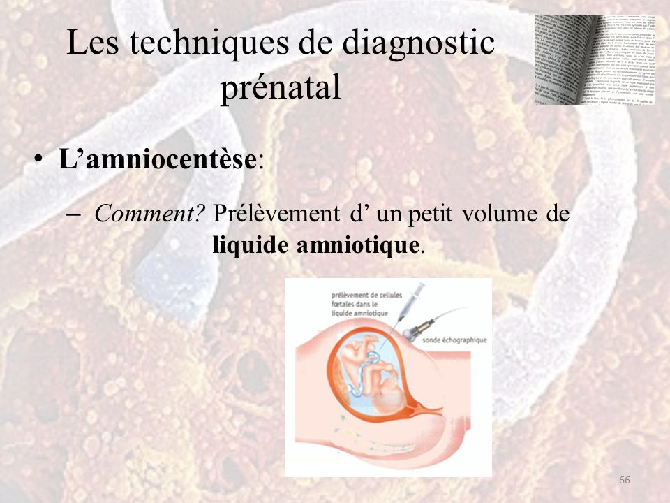 Les techniques de diagnostic prénatal L’amniocentèse: – Comment.