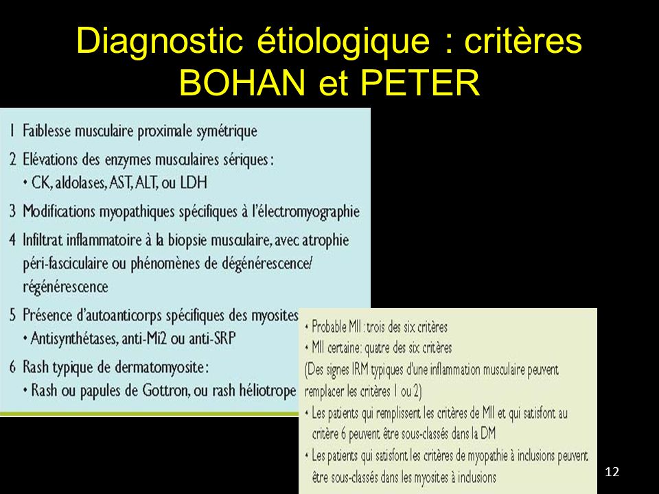 Diagnostic étiologique : critères BOHAN et PETER 12
