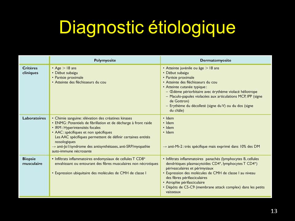 Diagnostic étiologique 13