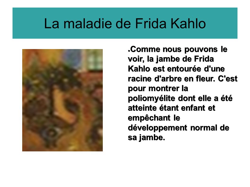 La maladie de Frida Kahlo ● Comme nous pouvons le voir, la jambe de Frida Kahlo est entourée d une racine d arbre en fleur.