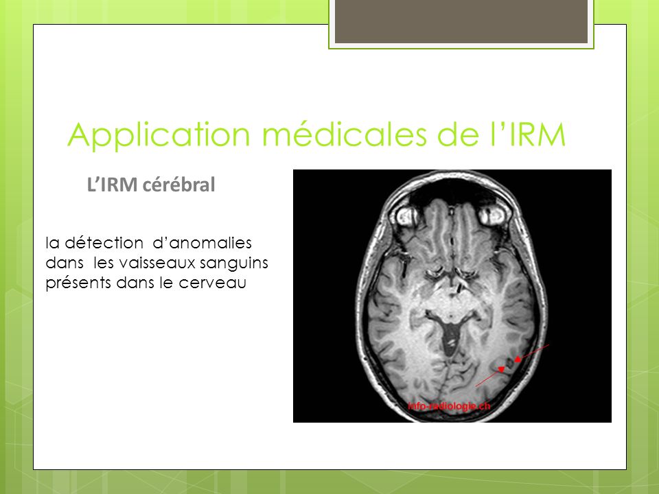 Application médicales de l’IRM L’IRM cérébral la détection d’anomalies dans les vaisseaux sanguins présents dans le cerveau